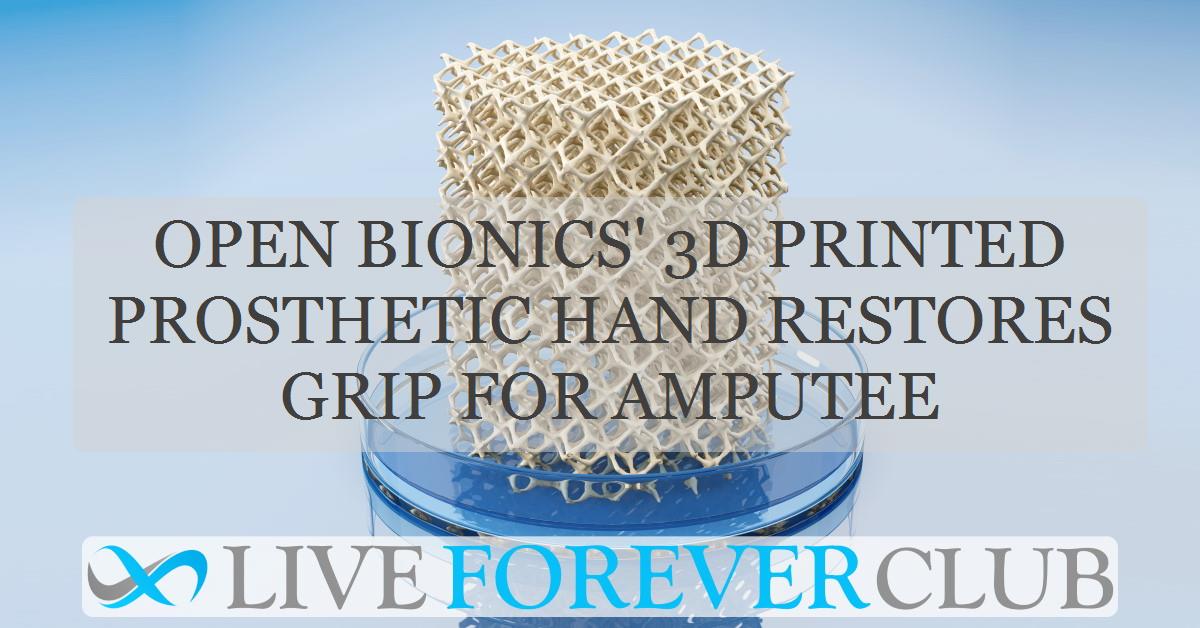 Open Bionics' 3D printed prosthetic hand restores grip for amputee