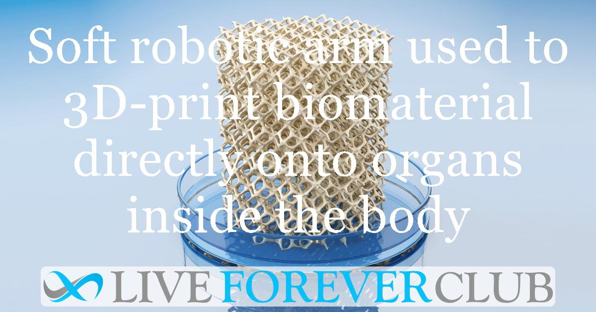 Soft robotic arm used to 3D-print biomaterial directly onto organs inside the body