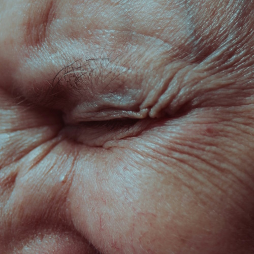 More Advanced Glycation End Products (AGEs) information, news and resources