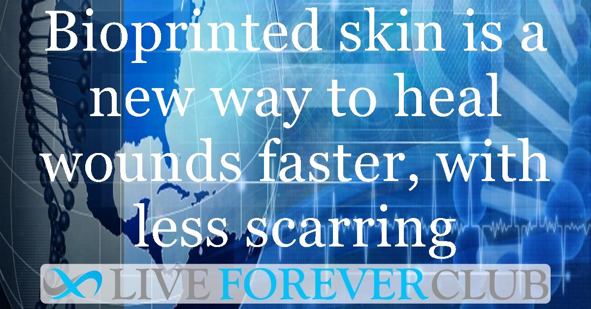 Bioprinted skin is a new way to heal wounds faster, with less scarring
