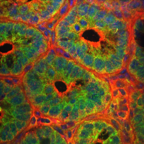 More Autophagy information, news and resources