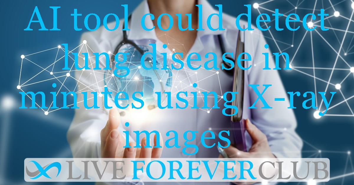 AI tool could detect lung disease in minutes using X-ray images