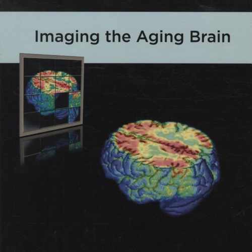 Imaging the Aging Brain information and news