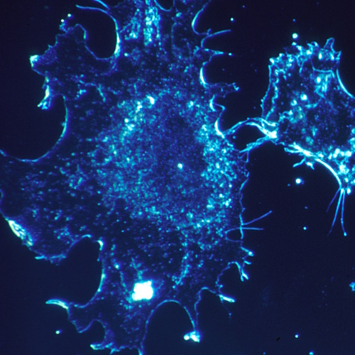 Regular exercise after chemotherapy helps colon cancer patients live longer
