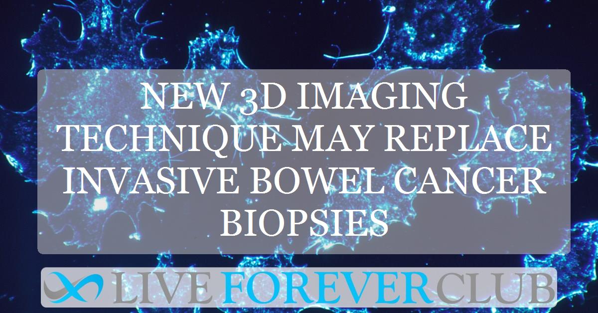 New 3D imaging technique may replace invasive bowel cancer biopsies