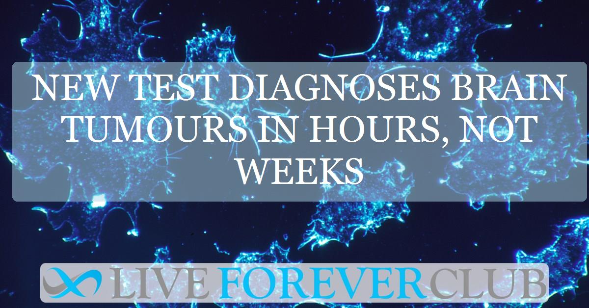 New test diagnoses brain tumours in hours, not weeks