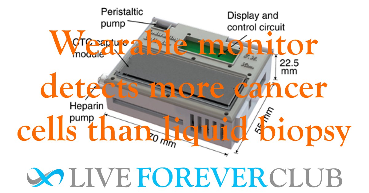 Wearable monitor detects more cancer cells than liquid biopsy
