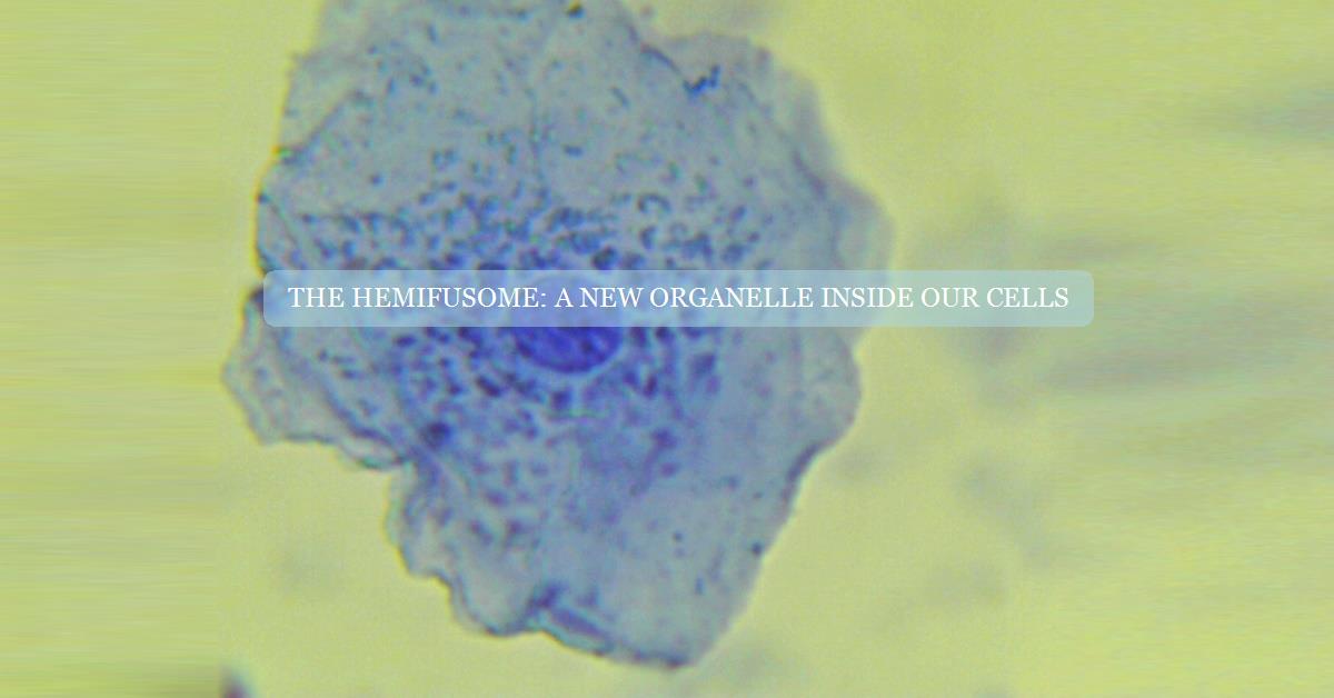 The hemifusome: A new organelle inside our cells