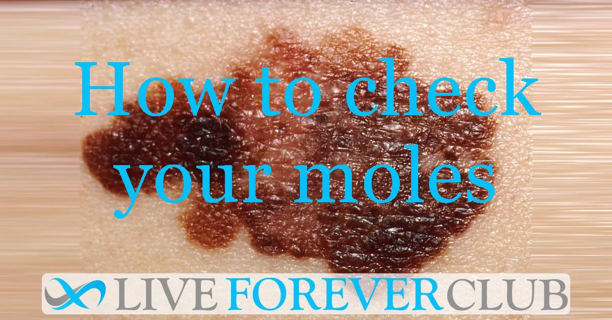 Monitoring moles with whole-body photography