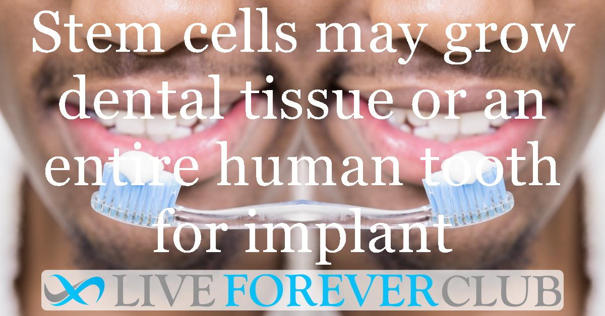Stem cells may grow dental tissue or an entire human tooth for implant