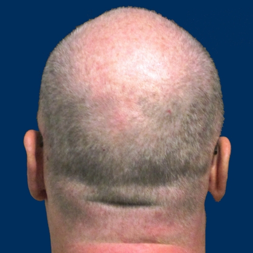 Scientists made hair grow faster by supercharging a natural cell cleanup process