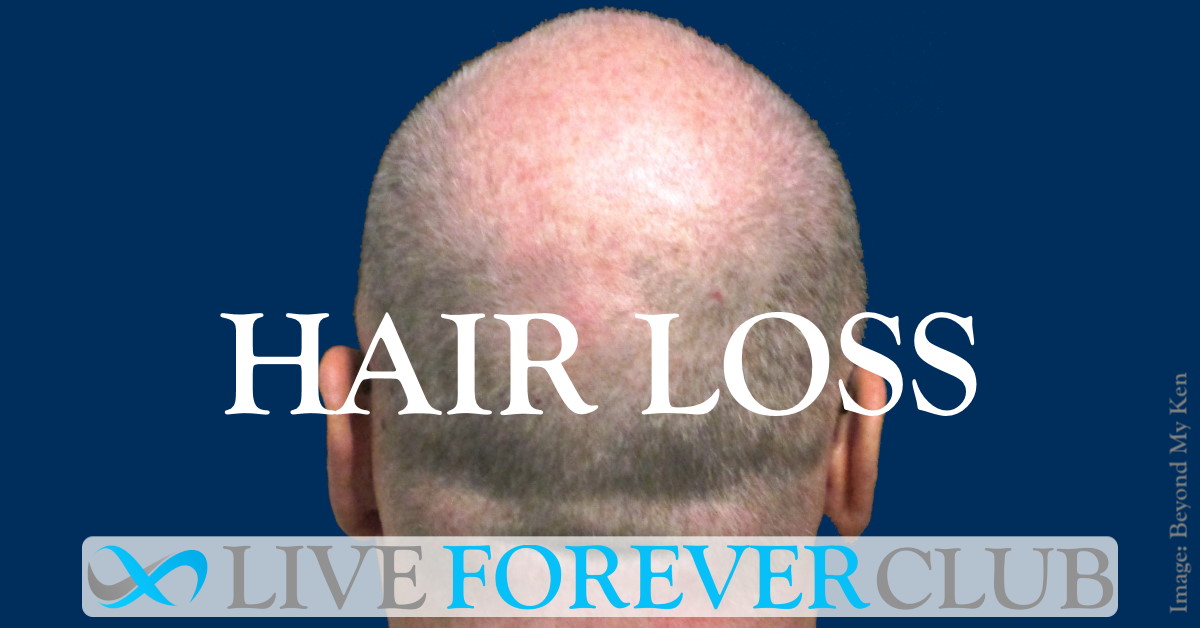 Hair loss