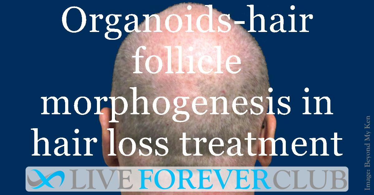Organoids-hair follicle morphogenesis in hair loss treatment