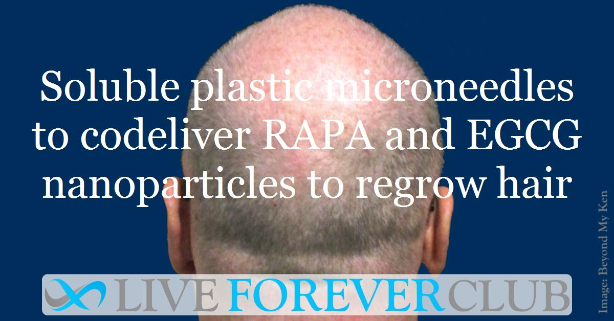 Soluble plastic microneedles to codeliver RAPA and EGCG nanoparticles to regrow hair