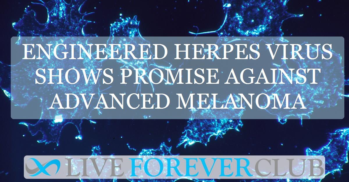 Engineered herpes virus shows promise against advanced melanoma