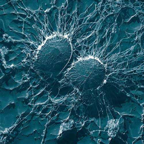 Unlocking the gut virome: viruses step into precision medicine spotlight