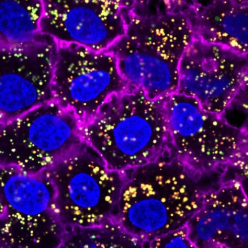 Two drug molecules delivered via nanoparticles to combat atherosclerosis