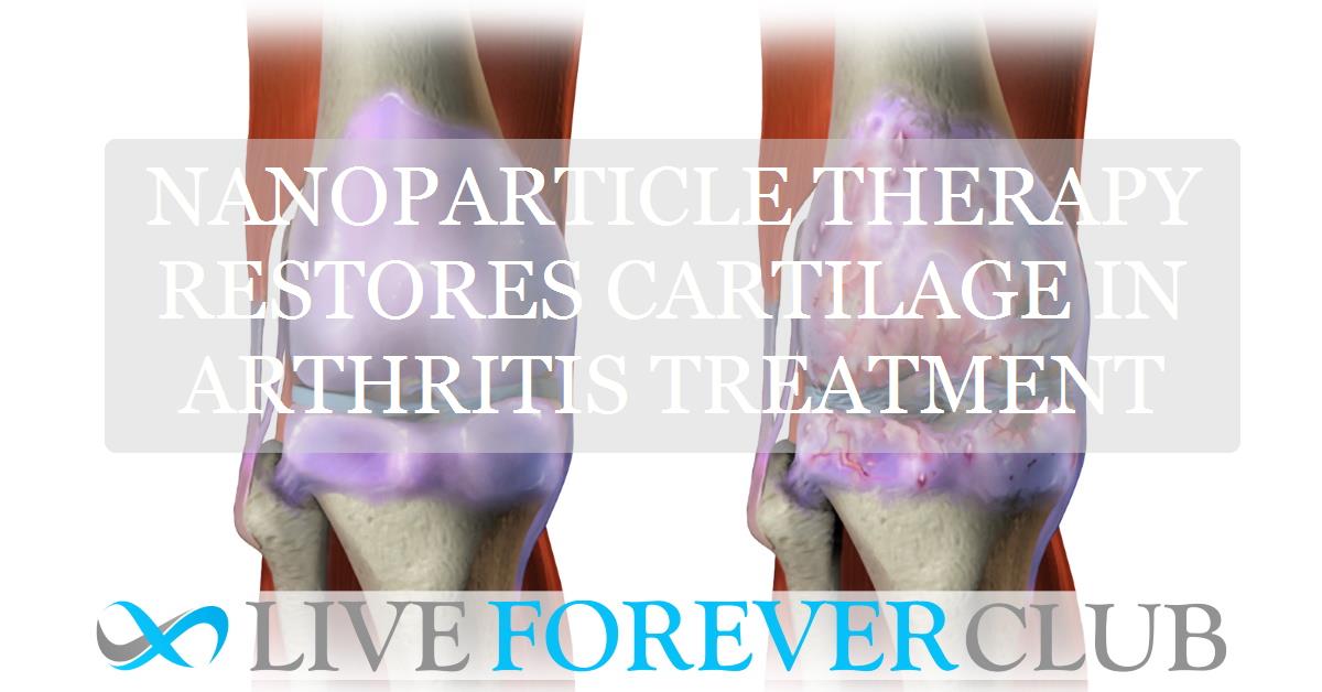 Nanoparticle therapy restores cartilage in arthritis treatment