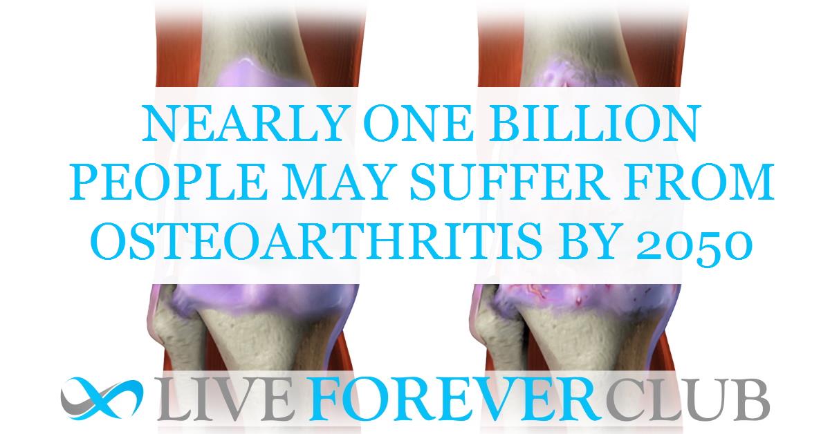 Nearly one billion people may suffer from osteoarthritis by 2050