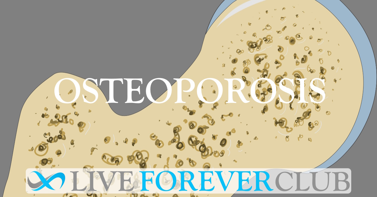 Osteoporosis