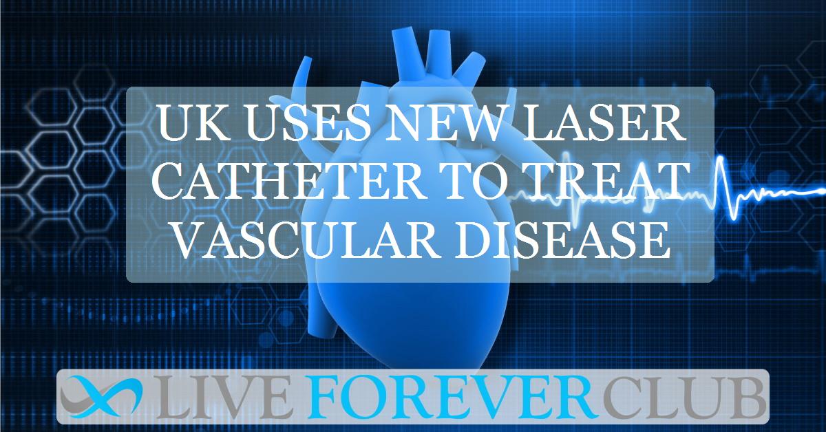 UK uses new laser catheter to treat vascular disease