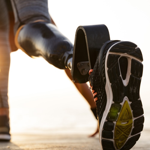 More Prostheses information, news and resources