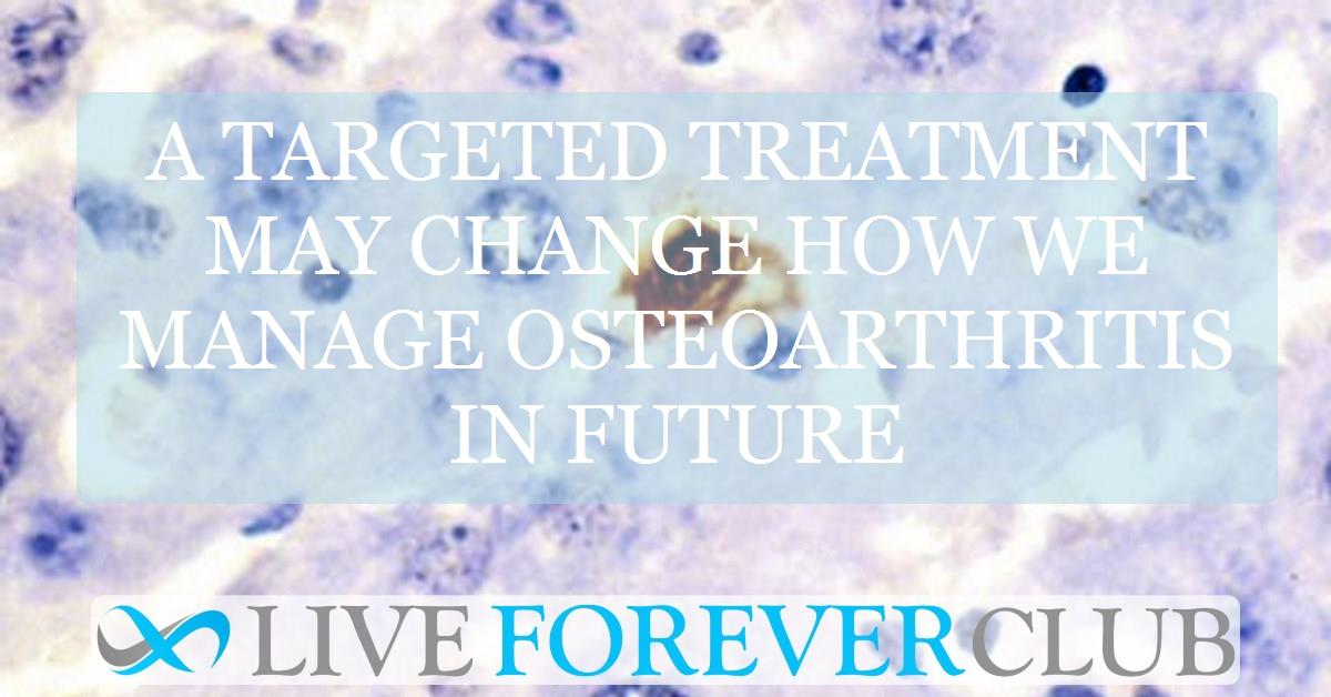 A targeted treatment may change how we manage osteoarthritis in future