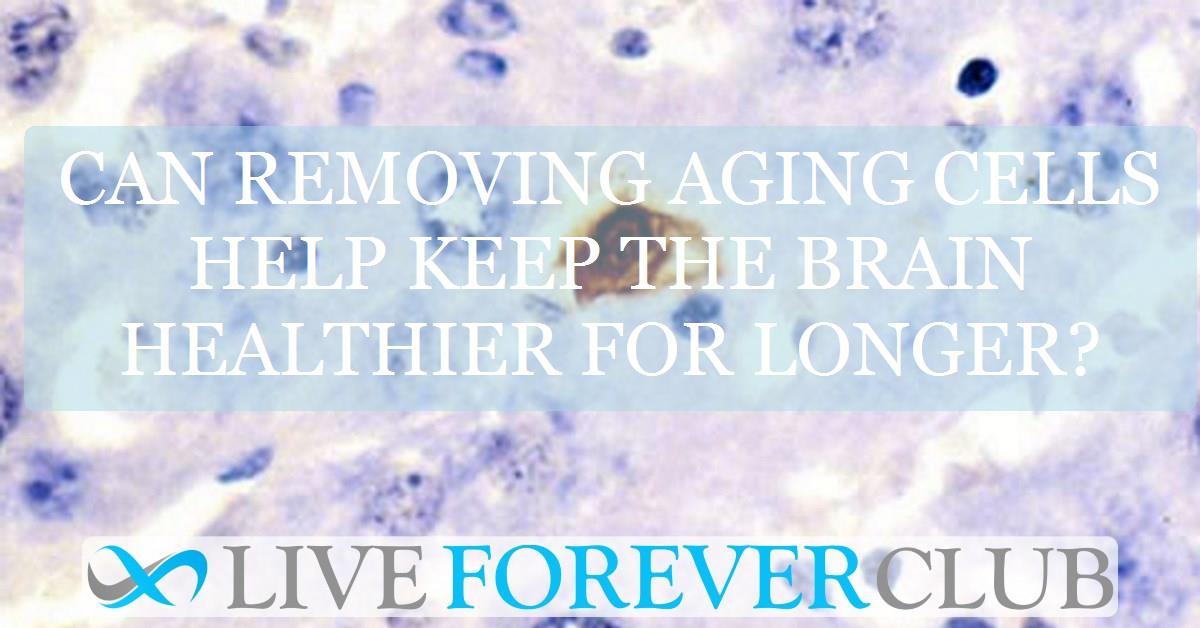 Can removing aging cells help keep the brain healthier for longer?