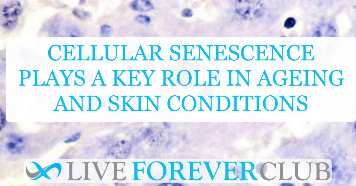 Cellular senescence plays a key role in ageing and skin conditions