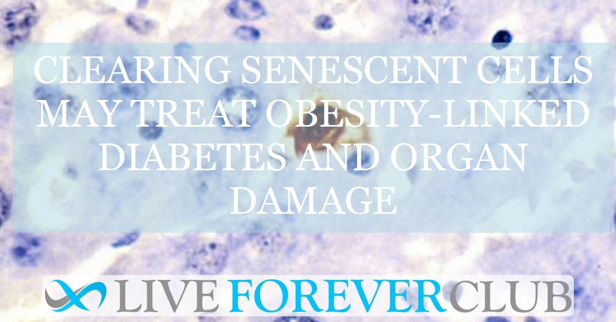 Clearing senescent cells may treat obesity-linked diabetes and organ damage