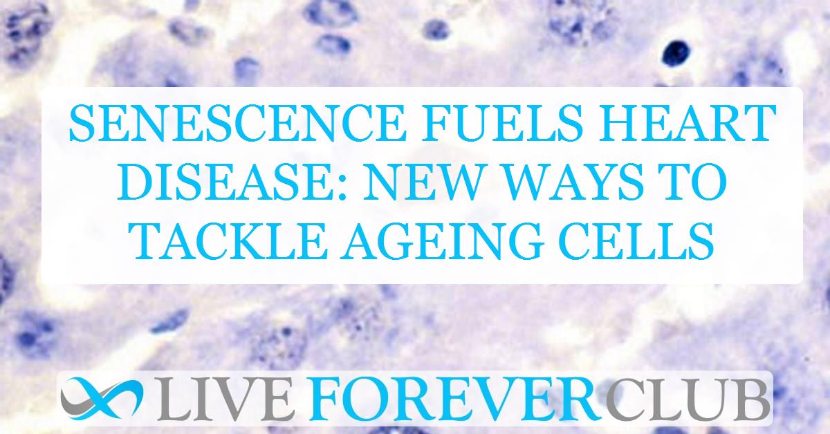 Senescence fuels heart disease: new ways to tackle ageing cells