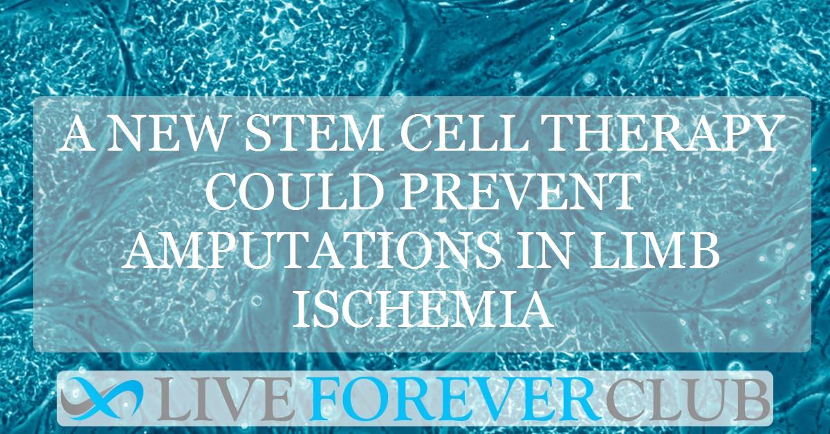 A new stem cell therapy could prevent amputations in limb ischemia