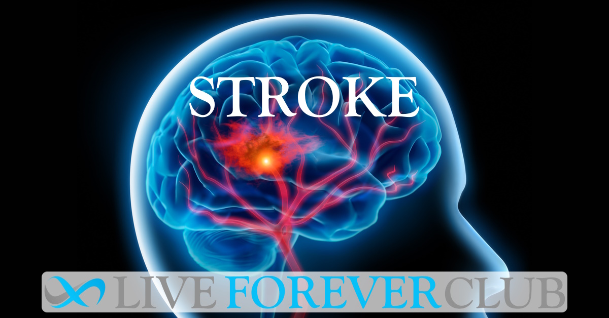 Stroke Treatment