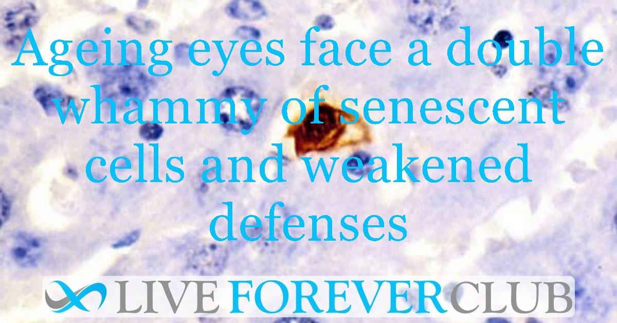 Ageing eyes face a double whammy of senescent cells and weakened defenses