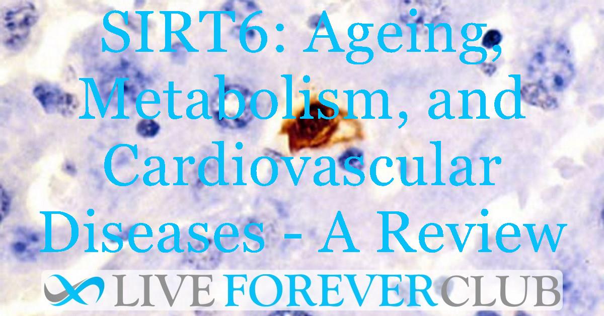 SIRT6: Ageing, Metabolism, and Cardiovascular Diseases - A Review
