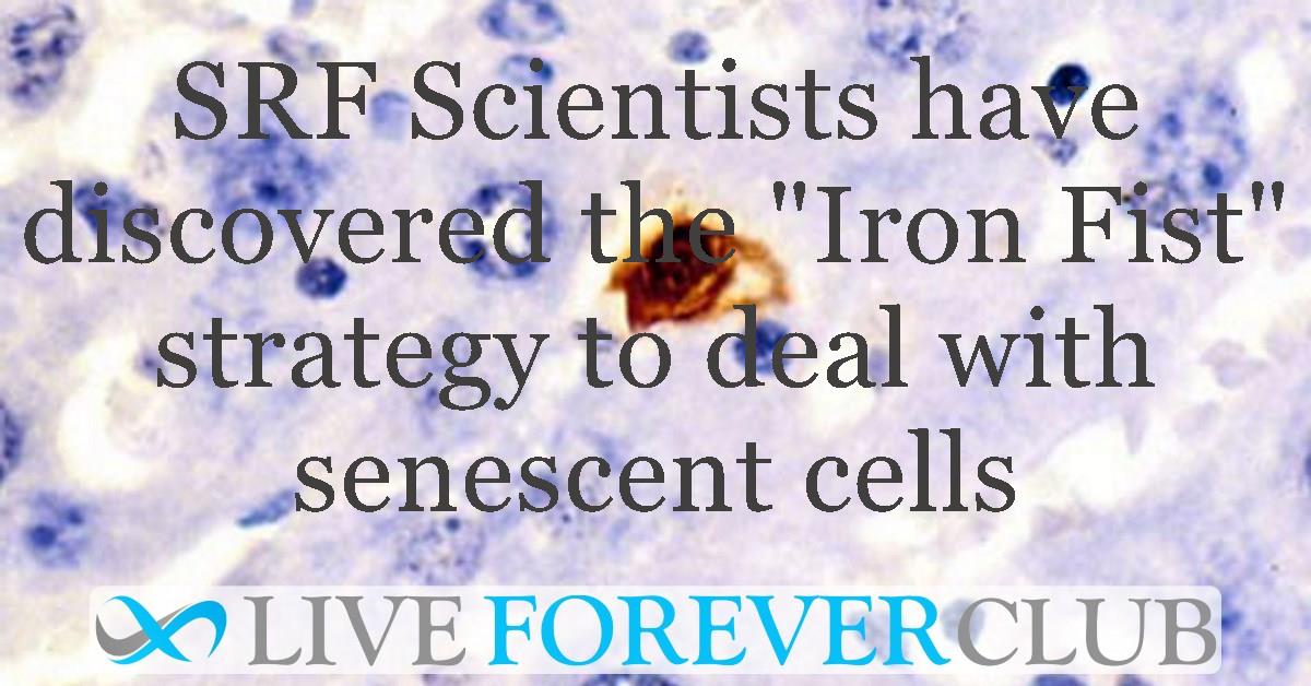 SRF Scientists have discovered the "Iron Fist" strategy to deal with senescent cells