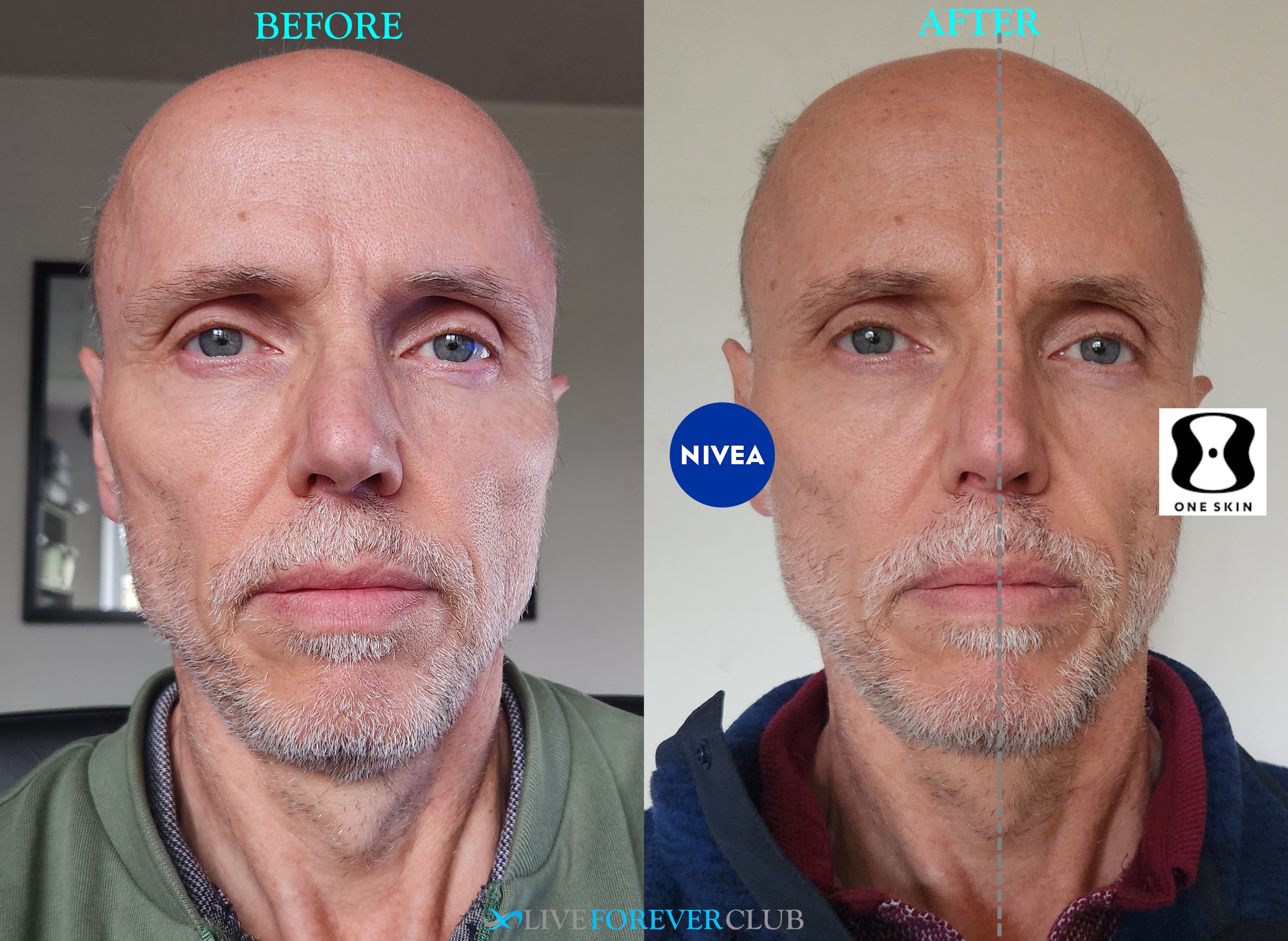 OneSkin face trial comparison