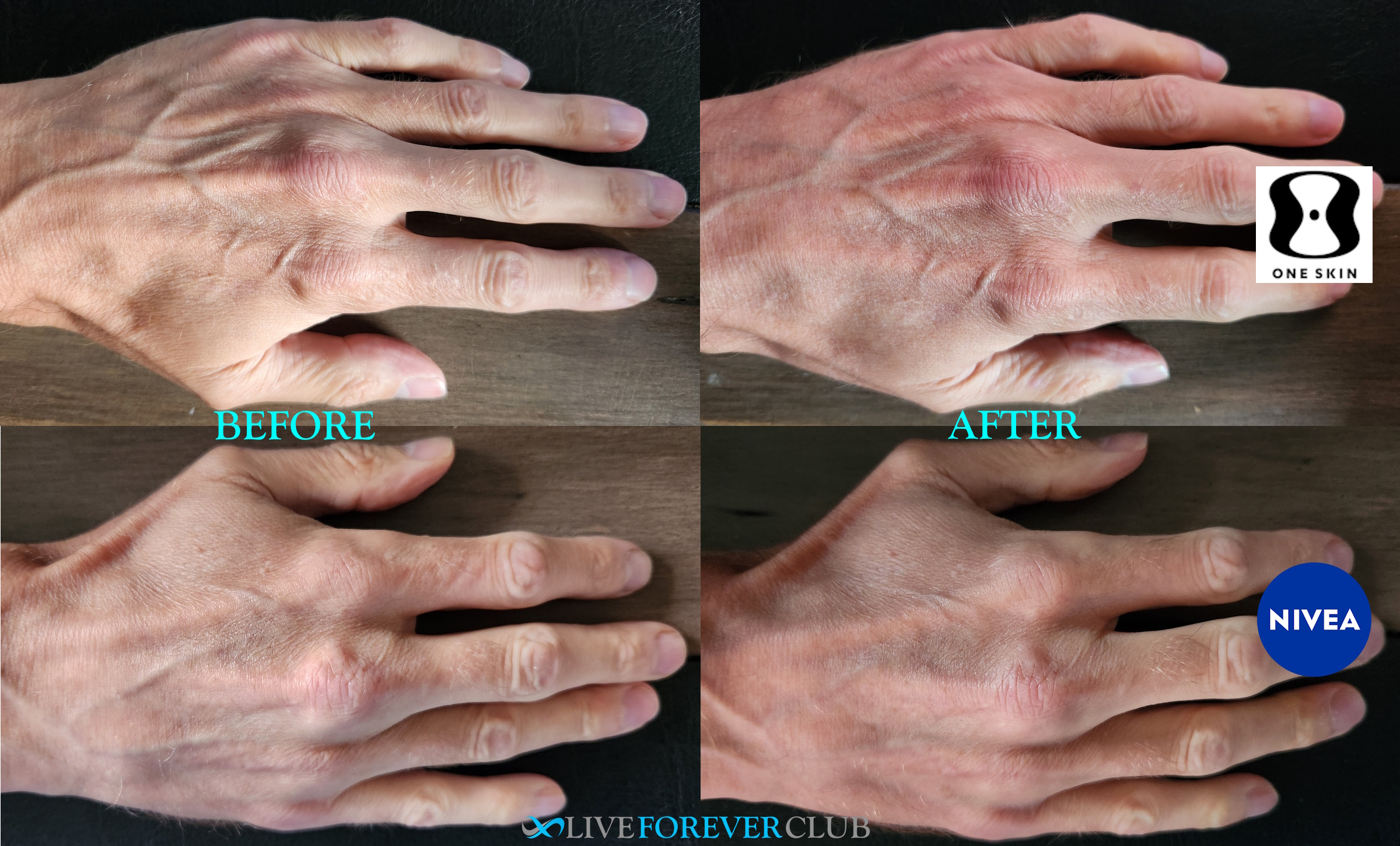 OneSkin hand trial comparison