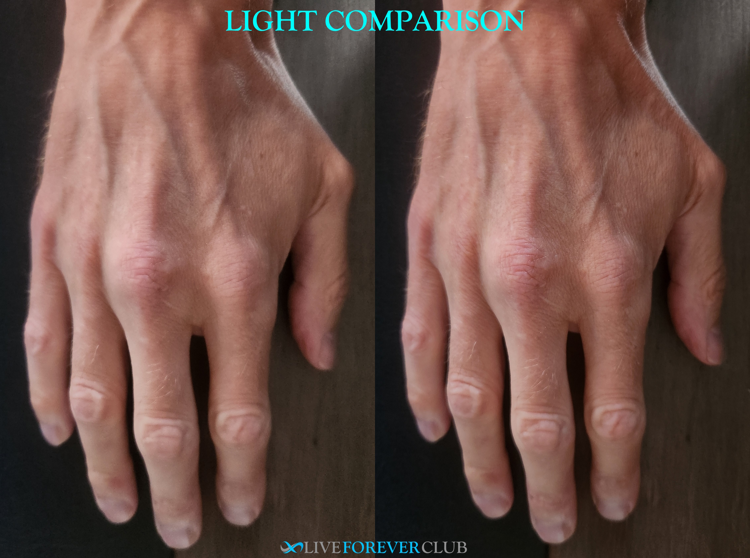 photo light comparison skin appearance