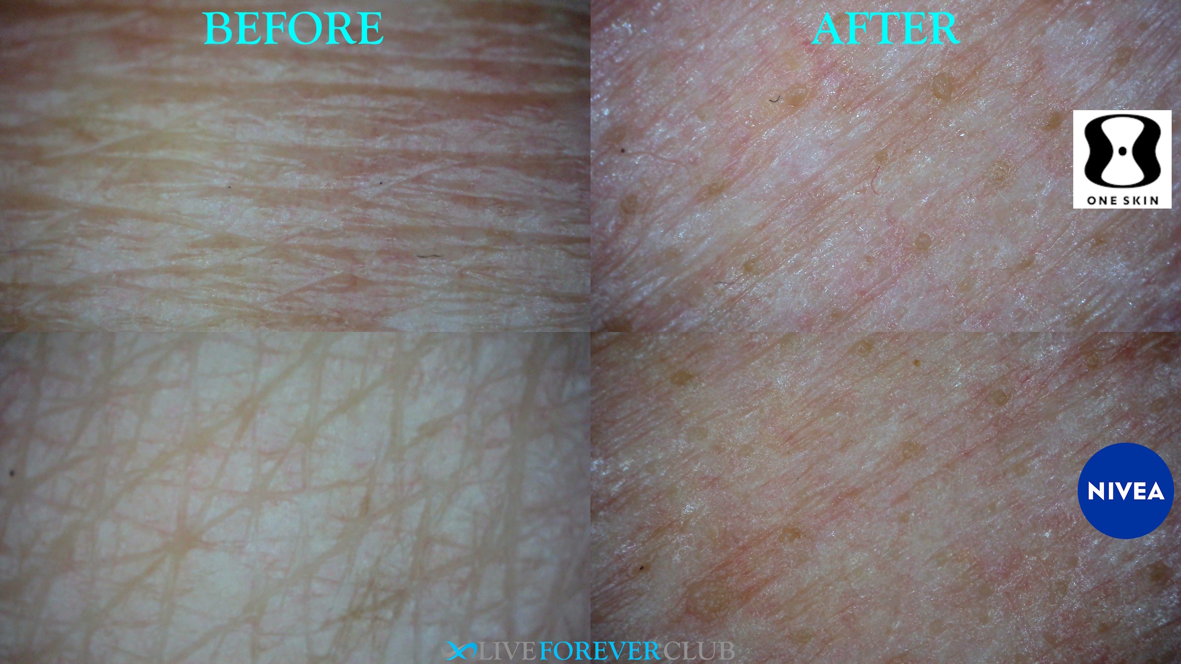 microscope hand trial comparison