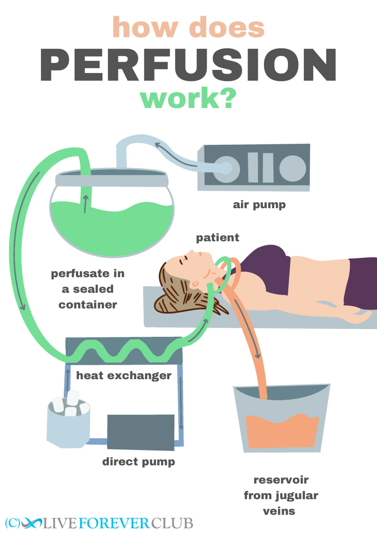 cryonics perfusion