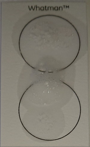 TruMe TruAge test sample card second spit