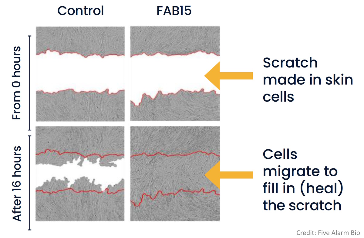 Cell migration in scratch test model of wound healing