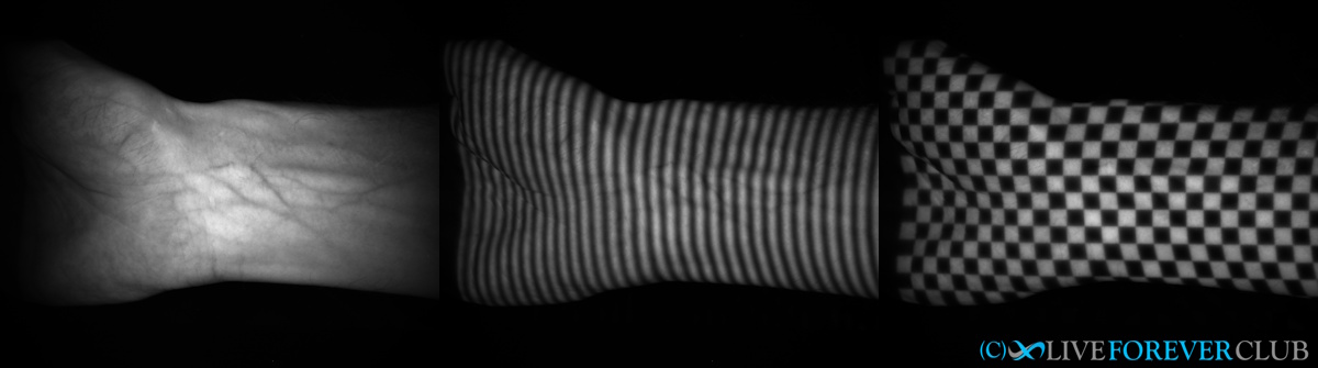 Neko microcirculation images