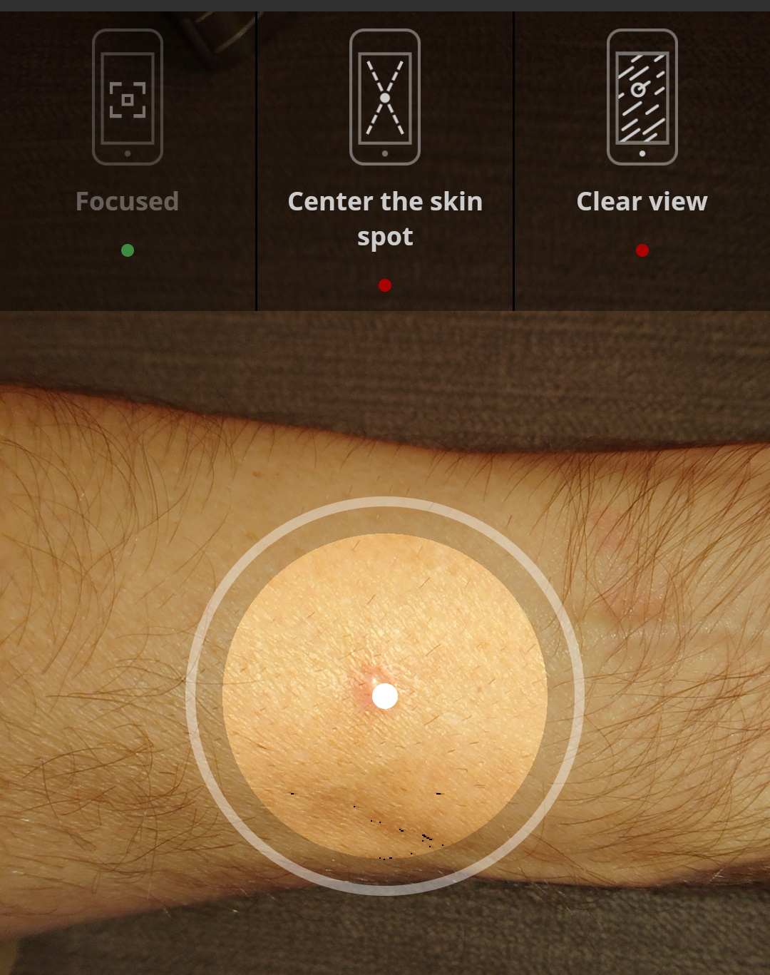 SkinVision app taking an image